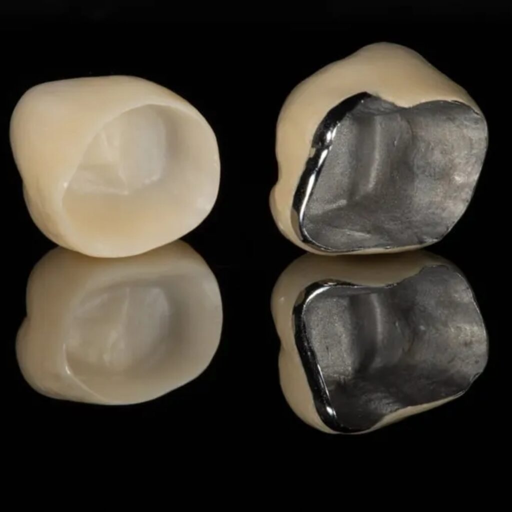 Ceramic Crowns Image