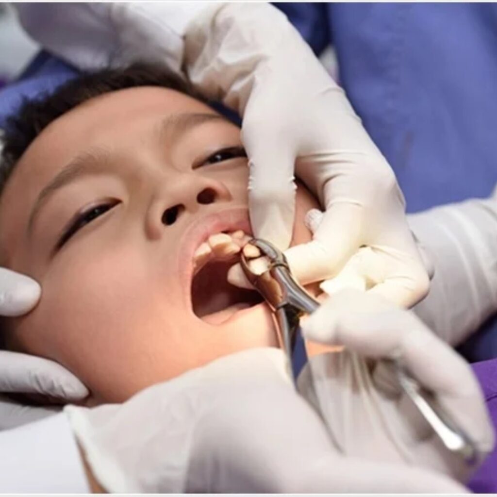 Extractions (all types) Image