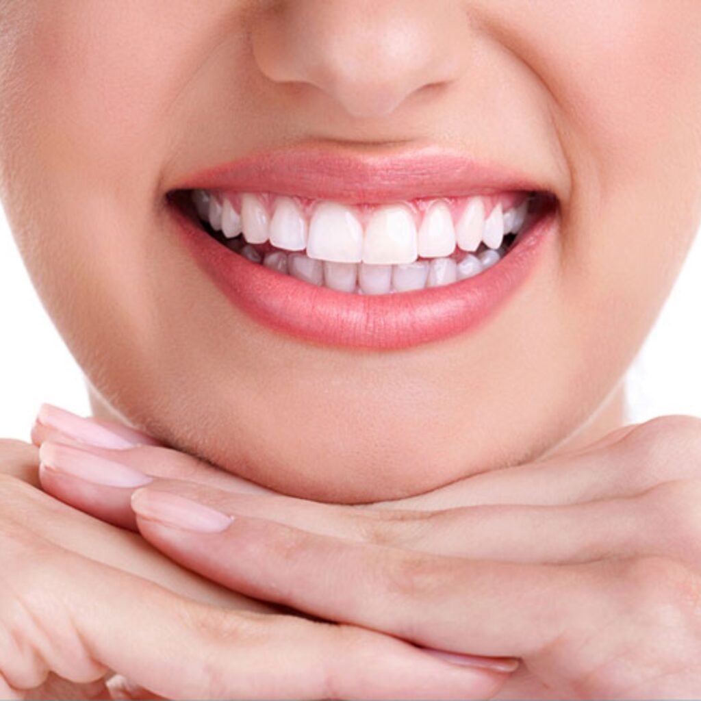 Smile Designing Image